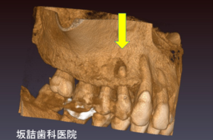 痛みとお薬の話