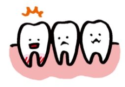 歯が溶けるとは？