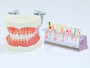 歯周病治療は歯科医院の総合力