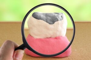 動画で見る歯科治療2026年4月